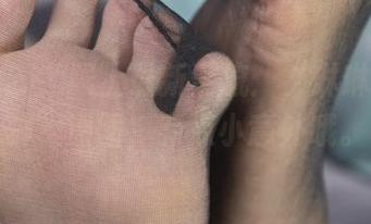 First Image